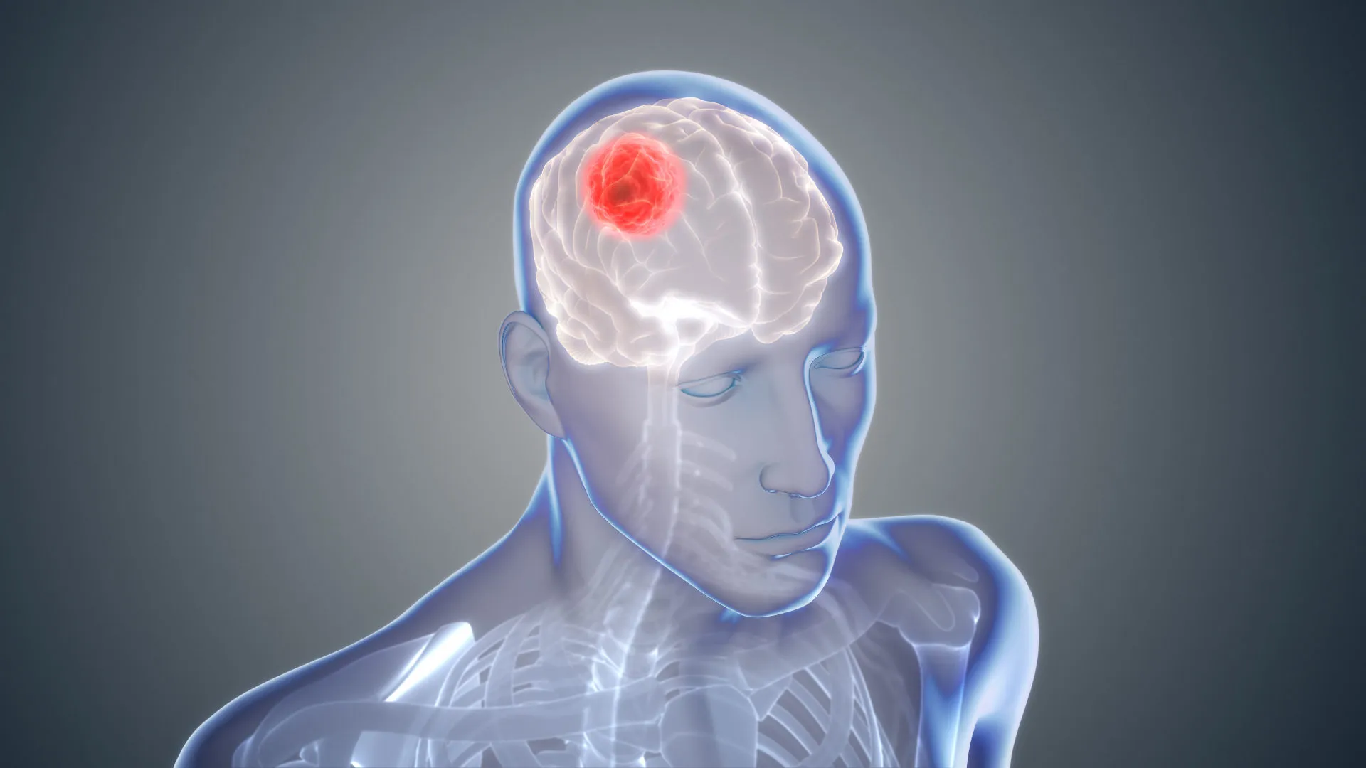 World Brain Tumor Day : बिना किसी संकेत के ही हावी हो जाता है ब्रेन ट्यूमर