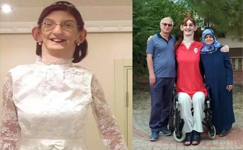 World Tallest Woman : ये है दुनिया की सबसे लंबी महिला, इस वजह से बढ़ी बेहिसाब हाइट!